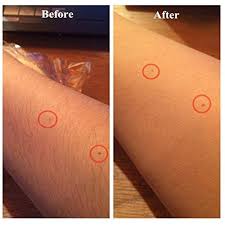 Nonetheless, you don't have to lose your sleep over this as there are several methods you can consider for arm hair compared to most other methods for removing hair from your arms, laser hair removal treatment usually provides the best results. 1pc New Magic Painless Hair Removal Depilation Sponge Pad Save Way To Remove Hair Leg Arm Hair Remover Effective Pricepulse