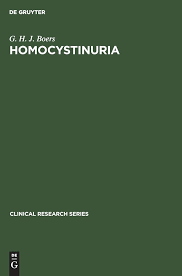 Image result for Homocystinuria