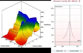 Image result for Tympanometry
