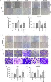 Maybe you would like to learn more about one of these? Mir 140 5p Inhibits The Proliferation Of Multiple Myeloma Cells By Targeting Vegfa