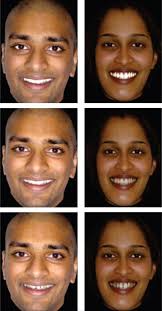 The influence of tooth colour