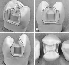Dental Journal Of Dentistry Open Access