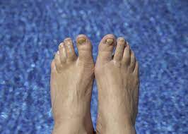 Guia de compras salud remedios para curar los hongos en las uñas de las manos y los pies sin importar el origen del hongo, estos productos te pueden ayudar. Como Acabar Con Los Hongos De Las Unas De Los Pies