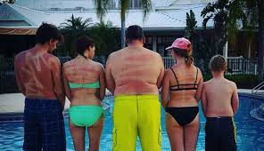 These People Used Spray On Sunscreen Incorrectly And Their Tan Lines Are Unbelievably Insane Self