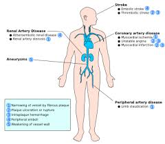 Atherosclerosis Textbook Of Cardiology