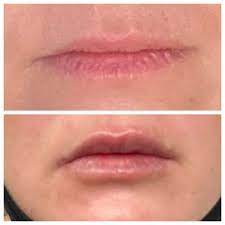 Ageless aesthetics medispa · 2815 lexington ave ste 4, ashland, ky 41101. Ageless Aesthetics Medispa Medical Spas 2815 Lexington Ave Ashland Ky Phone Number Services Yelp