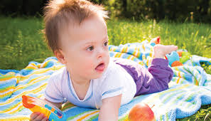 MRI Study for Infants with Down Syndrome