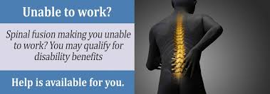Image result for what does medicare pay for a cervical spinal fusion