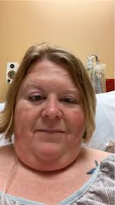 Wish me luck and prayers for sleeve surgery today