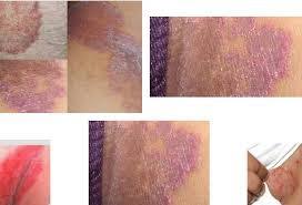 We did not find results for: Bintik Bintik Merah Dan Lecet Gatal Di Area Selangkangan My Website Powered By Doodlekit