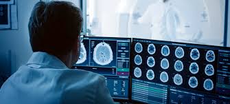 1 department of diagnostic radiology, wolfson medical center, holon, israel. Experts Stress On Radiology Preparedness For Covid 19 Express Healthcare