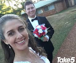 My eczema flared up after stopping steroids, before my wedding