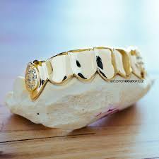 How To Make Custom Grillz Slugs And Gold Teeth Secrets Explained Custom Gold Grillz