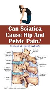 Pin Na Doske Best Sciatica Relief