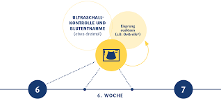 Also wäre der es morgen abend. Ivf Kinderwunschzentrum