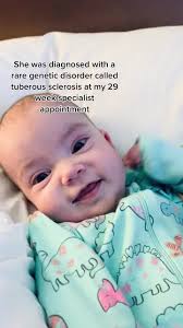 Esclerosis Tuberosa Bebes