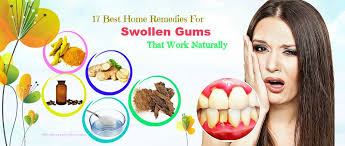 17 best home remes for swollen gums