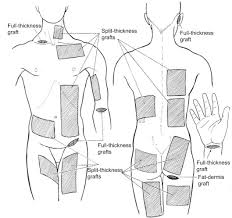نتیجه جستجوی لغت [graft] در گوگل