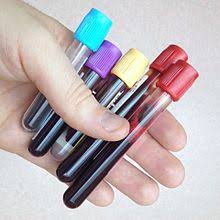 Emergency medical products (emp) offers supplies such as sets, collection tubes, safety needles, holders and more. Venipuncture Wikipedia