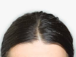 Remember that your hair won't feel the same as you're used to, so give it a few weeks before deciding! Hair Scalp Pain When You Do Not Wash It Why Does Hair Hurt When It S Dirty