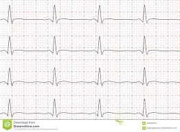 Ekg Heart Rate Chart 2019