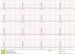 Ekg Heart Rate Chart 2019