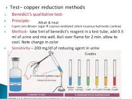 Urine Examination