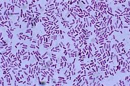 Salmonella typhi identification and its biochemical characteristics. Stock Image Photomicrograph Of Salmonella Sp A Gram Negative Enteric Rod Bacterium Mag 1000x At 24 X 36 Mm Salmonella Can Cause Food Poisoning Salmonellosis Typhoid Fever And Paratyphoid Fever 6172 01b0w32a
