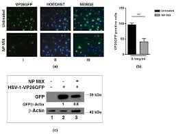 Besides, igm antibodies may also be detectable in cases of recurrent or persistent infection. Plants Free Full Text In Vitro Anti Hsv 1 Activity Of Polyphenol Rich Extracts And Pure Polyphenol Compounds Derived From Pistachios Kernels Pistacia Vera L Html