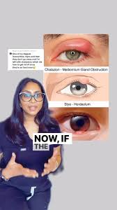 Image result for Styppeiochloa