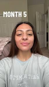 Yamini Patel (@yaminipatel415)