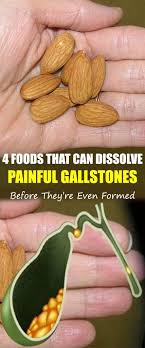 4 Foods That Can Dissolve Painful Gallstones Before They Re Even Formed Gallstones Food Gallstone Diet