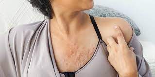 Kanker payudara juga dapat menyebar ke kelenjar getah bening di sekitar ketiak. Tanda Kanser Payudara Awal Yang Sering Wanita Terlepas Pandang