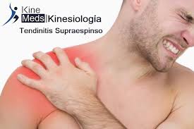 Kinesiólogo Eduardo Escobar E.