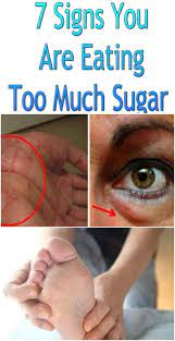 7 Signs You Are Eating Too Much Sugar Medi Idea Ate Too Much Holistic Medicine Health