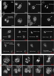We offer customized needle detector with cheap price. Cohesin Depleted Cells Rebuild Functional Nuclear Compartments After Endomitosis Nature Communications
