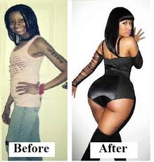 See more ideas about nicki minaj, plastic surgery, celebrity plastic surgery. Nicki Minaj Young Beauty Before Plastic Surgery Toptenfamous Co