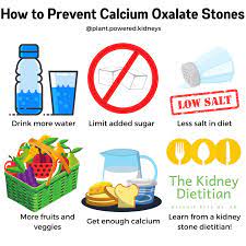 10 Tips To Prevent Kidney Stones Naturally
