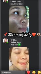 ຕົວແທນຂາຍຄີມ...