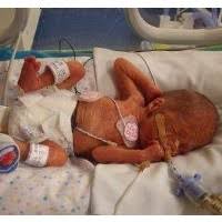 Dia akan lebih ekspresif dalam merespon orangtua. Bayi 4 Bulan Lahir Sempurna Di Toilet