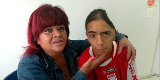 En las últimas 24 horas fueron 2.928 nuevos casos. Retiran Parte Del Craneo De Un Hincha De Santa Fe Agredido Por Barristas De Millonarios Noticentro 1 Cm