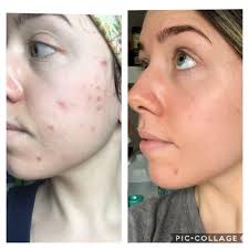 TOP 10 BEST Anatomy Tattoo in Denver, CO