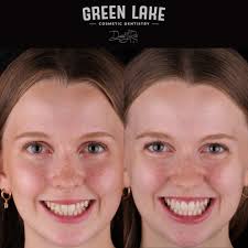 Green Lake Cosmetic Dentistry