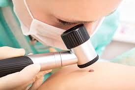 The most common types of cancer associated with lfs include: Could Benign Skin Cancers Foretell Something Worse