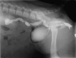 Image result for Intravenous Pyelogram