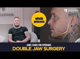 Double Jaw(Orthognathic) Surgery for Sleep Apnea patient
