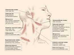 Lymph node cancer symptoms in hodgkin's lymphoma. Lymphadenopathy Cancer Therapy Advisor