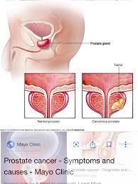 Prostatic acid phosphatase (pap), a glycoprotein synthesized by the prostate gland, is a member of a diverse group of isoenzymes that are capable of hydrolyzing phosphate esters in acidic medium. May 28 2019 Prostate Cancer Part 1 The Prostate Is Part Of Men S Reproductive System It Is Located In Front Of The Rectum And Under The Bladder It Surrounds The Urethra The Tube