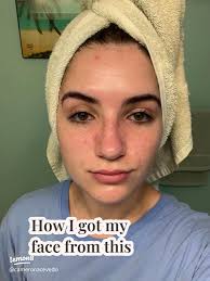 17 top Michael Ang Skincare ideas in 2024