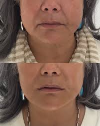 Christine Ibrahim MD, MPH (@drchristineibrahim) · Beverly Hills, CA